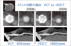 VCTHDCTŎBeꊳ҂̃Ri[Xeg摜