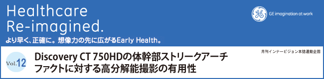 Discovery CT 750HD̑̊Xg[NA[`t@Ngɑ΂鍂\Be̗Lp  wwa@ː@c  /  i / J_ / naj