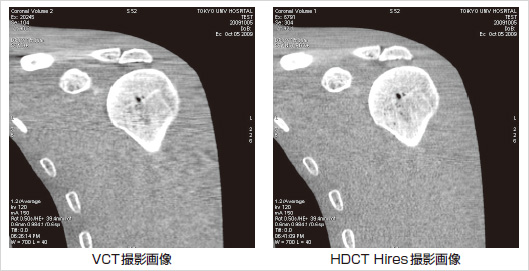 }1@ l̃t@gMPR摜ɂ鎋oIȔr@A[`t@Ngڗ邽߂ɒʁAItZ^[̈ŎBeB