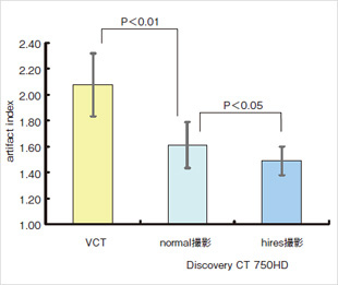 }5@artifact indexɂ]