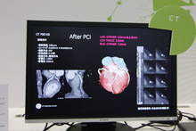 uDiscovery CT 750HDv̐SCǌñAvP[V摜v[e[VŏЉ