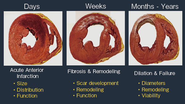 }3@Chronic Heart Failure and Imaging