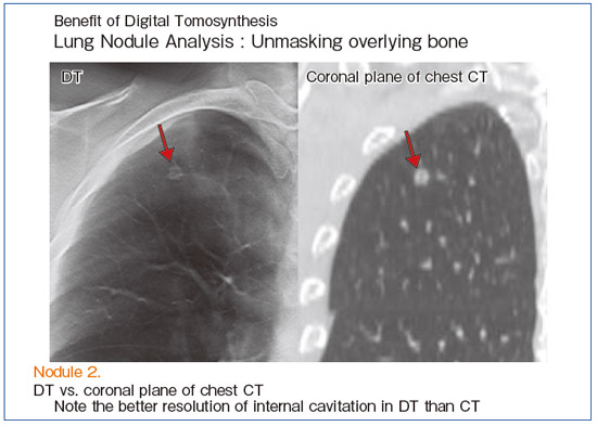 }1@Ǘ1F咰x]ځi57΁Cjj