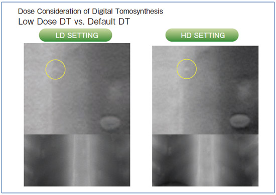 }3@WʂƒʂɂfW^gVZVX摜̔r
