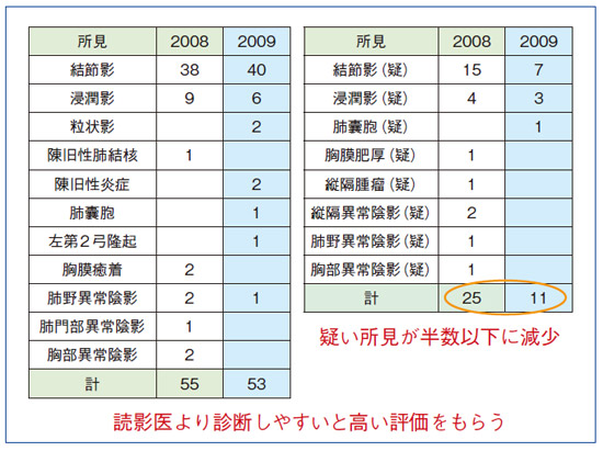 }2@ Definium8000 O̗vr