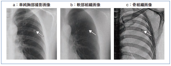 }4@ 38΁CjBaŌ߂炵AeF߂ꂽCƐffꂽB