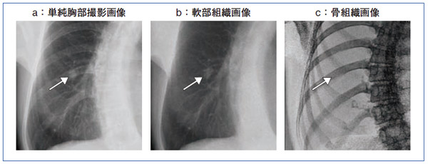 }5@ 56΁CB炩ȗzƂĔx񂪑ɐffłB