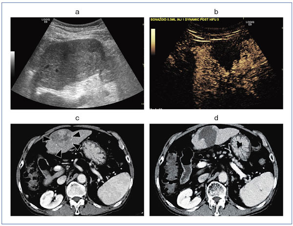 }2@Ǘ1F5cm̔rI傫HCC