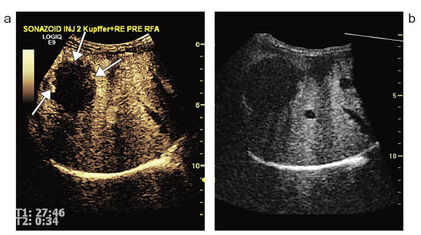 }4@Volume NavigationFusion@\