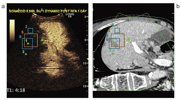 }5@Volume NavigationGPS@\