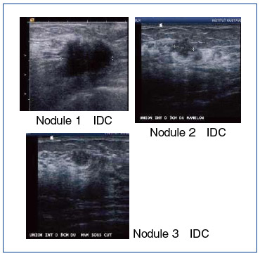 図2 症例1の超音波画像