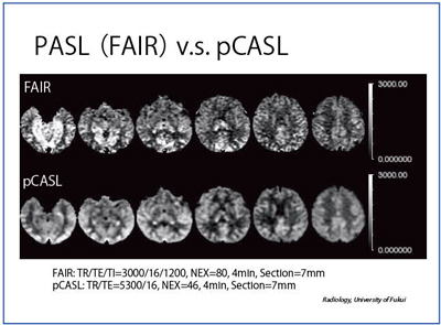 }4@pCASLPASLiFAIRj̔r