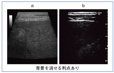 }3@Amplitude Modulationɂ錴̍זE̕`o