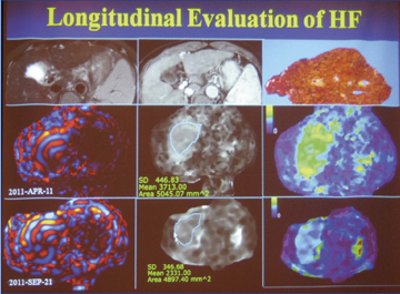 }3@MRGXgOtBF㏞̍dς̂ߊ̈ڐA󂯂C^̉Ǘ