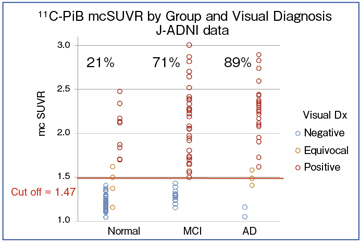 }1@PiB-PET̎oIǉeʁiJ-ADNIf[^j