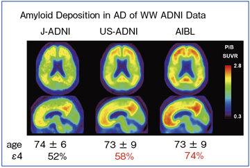 図2　J-ADNI，ADNI，AIBLにおける，AD患者のアミロイドPETの平均画像