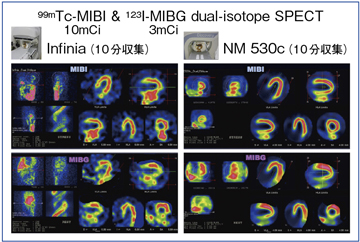 }6@j퓯W̃AK[^SPECTƔSPECT̔r