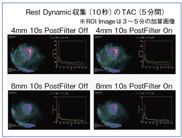 }7@99mTc-TF SPECT_Ci~bNWɂTime Activity Curve