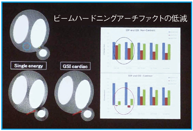 }6@t@gɂGSI CardiacɂS؟󗬉摜̕]
