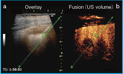 }7@Virtu TRAXɂRFA̐j惂j^iRITA Model-90j aFOverlayCbFFusioniUS volumej