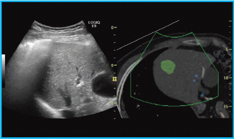 }4@S8h[ᇂ̏ǗiVolume Navigationj