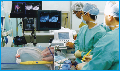 }5@Virtu TRAXppirQ[V̎