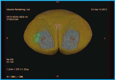 }7@Ǘ3FSPECT/CTt[W3Df