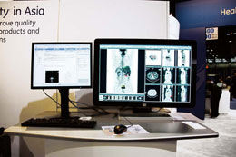 機能が拡張された「Centricity PACS IW」