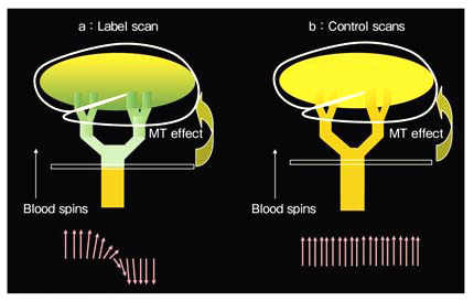 図1 CASL法の原理