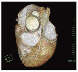 }3@Vu@XCXgbLOZpC}`XuBp3D HeartŎBVR