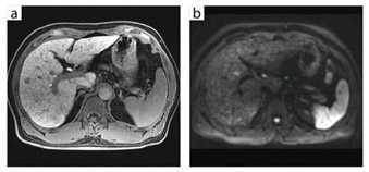 }2@^̍זEi32ch{fBACRCj