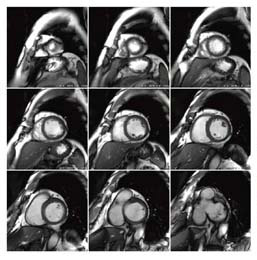 }6@SVl摜i32ch{fBACRCj