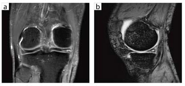 }9@EGEfiQD KneeRCj