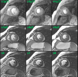 }2@ReportCARDMulti Series Viewer