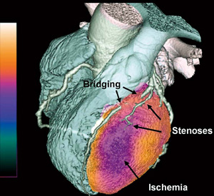 CardIQ Fusion\tgEFAɂ3Dt[W摜