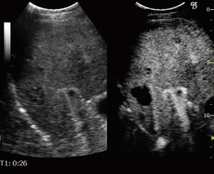 }3@Contrast DualView