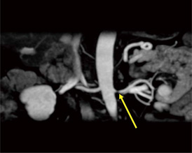 }4@LAVA-XV摜ij̃tH[}bg