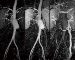 }6@TRICKS-XVɂ鍂4D MRA