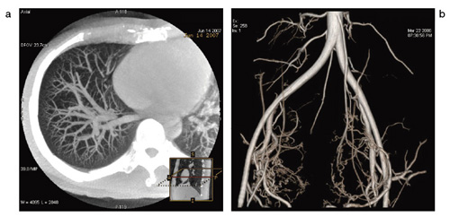 }2@CBCTiajInnova3Dibj