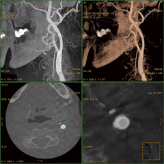 }4@Advantage Workstationɂ4ʗ