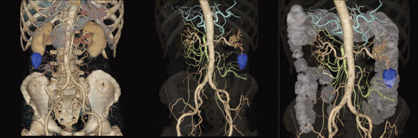 }1@AdvantageWorkstation VolumeShare2ɂ3D{[_Oł̃t[W