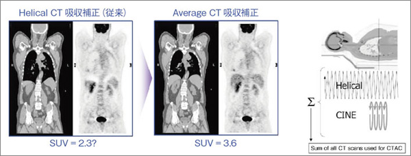 図2　Average CT吸収補正