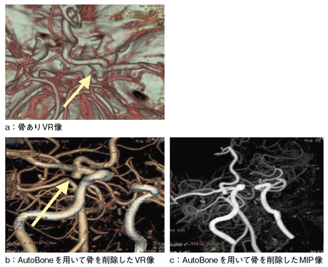 }2@AutoBonepč쐬Տ摜
