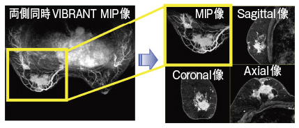}2@VIBRANT MIPijƔCӒfʂ̍č\摜iEj