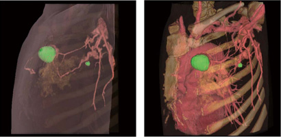 i摜񋟁FÖ@l{kۑa@lj
