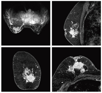 }3@VIBRANTi[Bji1.5Tj