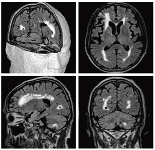 }4@CubeɂFLAIRBi1.5Tj