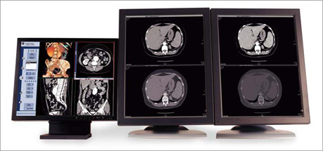 }2@3D͂\Centricity PACSiRA1000AW Suitej