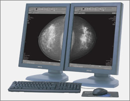 Centricity RA1000Mammo Workflow