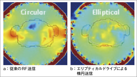 }3@GveBJhCuɂʁFtbvAOV~[V